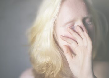 No dia de conscientização do albinismo, atriz fala sobre falta de representatividade: ‘Fica difícil se reconhecer’