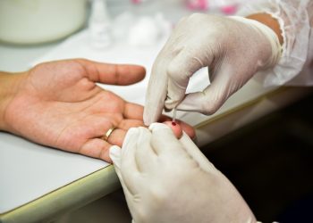 Pessoas do sexo masculino são maioria entre as diagnosticadas com o vírus HIV no oeste do Pará