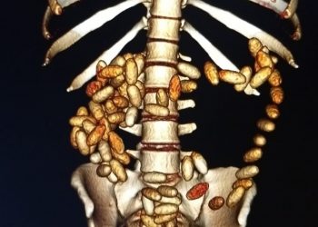 Jovem é preso ao tentar embarcar após ingerir capsulas de cocaína