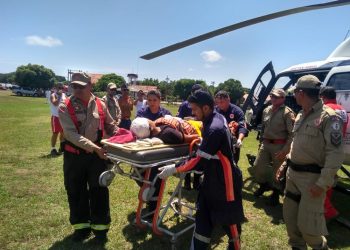 Jovem indígena teve 85% do couro cabeludo arrancado por eixo de motor, diz hospital