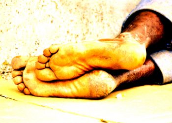 Morador de rua é queimado vivo enquanto dormia, em Parauapebas