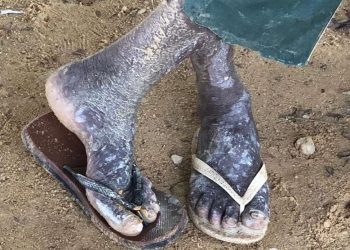 Pará é o segundo Estado do Brasil com mais ocorrências de trabalho escravo