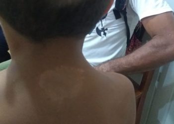 Prefeitura terá que garantir atendimento básico de saúde a moradores de comunidades do Alto Xingu