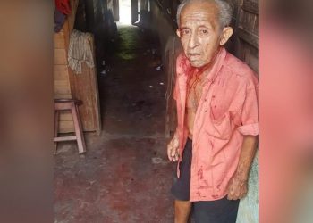 Idoso de 75 anos é ferido por cuidadora com paulada na cabeça durante roubo em Alenquer, PA