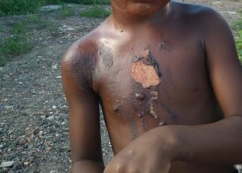 Crianças que viviam em condições precárias são resgatadas pela polícia