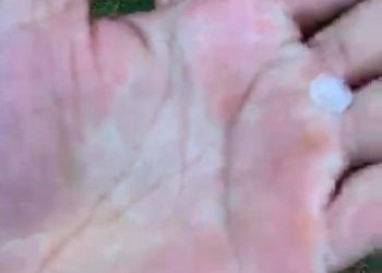 Chuva de granizo surpreende moradores da zona rural de Uruará