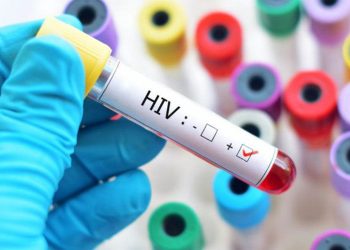 Pará é o segundo estado com maior número de mortes por HIV no Brasil