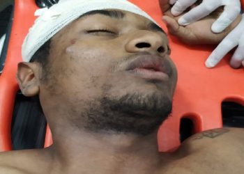 Morre ladrão que levou tiro após invadir casa de morador em Novo Progresso