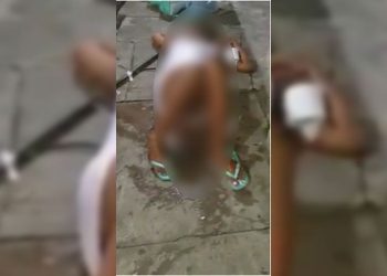 Bebê que nasceu em calçada de hospital passa por tratamento específico