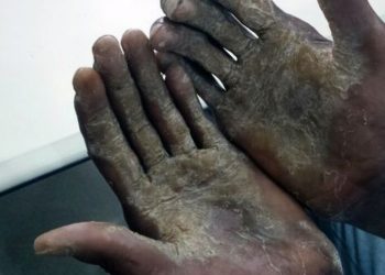 Sejudh realiza ações educativas no combate ao trabalho escravo