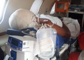 Oriximiná: Jovem vítima de escalpelamento perdeu 100% do couro cabeludo