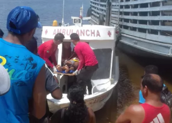 Jovem perde 100% do couro cabeludo após acidente com eixo de embarcação em Oriximiná