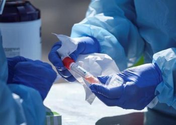 Brasil receberá novos testes da China para uso nos profissionais de saúde