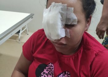 Mulher é agredida pelo ex-companheiro em Altamira
