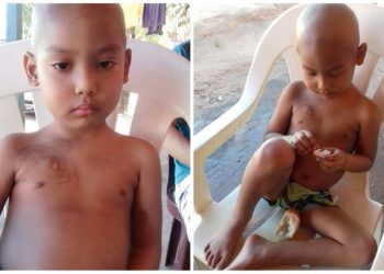 Com mãe desempregada, menino com leucemia está sem remédios há duas semanas em Santarém