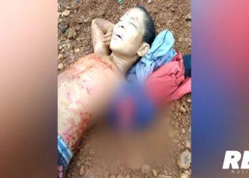 Criança de 9 anos tem braço arrancado em acidente na cidade de Medicilândia, no Pará