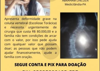 Adolescente de Medicilândia precisa de R$80 mil para fazer uma cirurgia de emergência