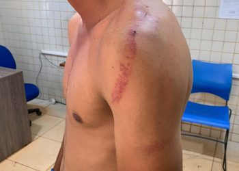 Homem sofre tentativa de homicídio em Medicilândia. O acusado morreu durante troca de tiros com a polícia