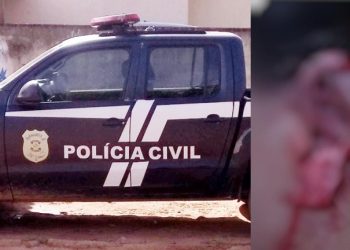 Em Uruará, duas mulheres brigam e uma fica sem um pedaço da orelha