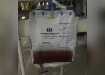 Escurecimento da urina é um dos sintomas da Síndrome de Haff, doença da urina preta — Foto: Reprodução/Redes sociais