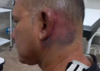 Jornalista acusa prefeito de Tucuruí e seguranças de sequestro e agressão