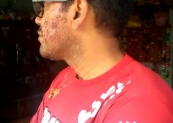 Vídeo com imagens do Secretário Marcelo Altamirense ferido foi gravado em 2019