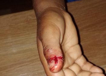 Em Medicilândia, PM prende suspeito por atirar contra uma criança de 5 anos