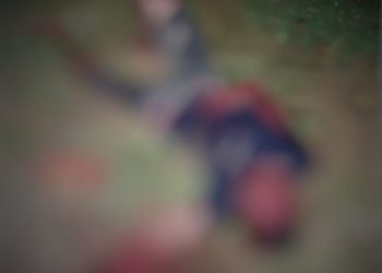 Altamira: Homem tem as duas mãos amputadas, após sofrer uma tentativa de homicídio