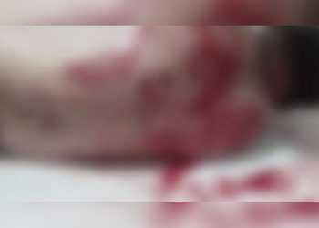 Homem leva 20 facadas por não pagar garota de programa no Pará