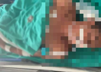 Bruno foi socorrido para o Hospital Municipal de Parauapebas (HMP), onde está internado em estado grave. (Reprodução/ Redes sociais)