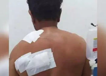 O estado de saúde do militar é considerado estável. (Reprodução / O Impacto)