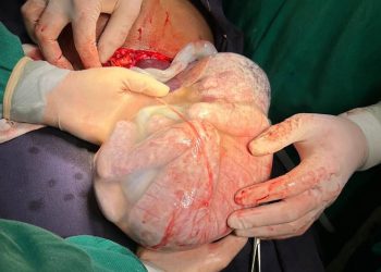 Foto: Divulgação / Agência Pará