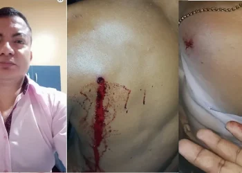 Polícia prendeu vereador (à esqueda da imagem) por suspeita de tentativa de homicídio; vítima foi atingida por dois tiros em Portel, no Marajó; — Foto: Reprodução