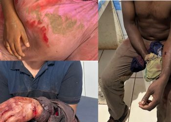 ‘Guerra do dendê’: pistoleiros deixam três pessoas feridas em 2ª invasão a aldeia do PA em menos de uma semana