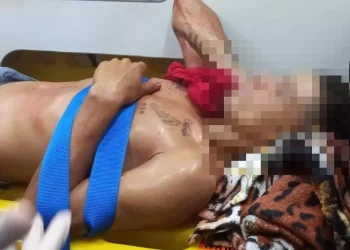 O homem baleado foi socorrido pelo Corpo de Bombeiros e encaminhado ao Hospital Regional do Tapajós (HRT) para receber atendimento médico especializado. O estado de saúde da vítima não foi revelado. (Reprodução / Portal Giro)