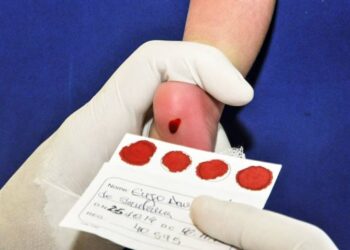 Secretaria de Saúde do Pará (Sespa) destaca importância do Teste do Pezinho