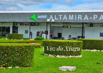 Mutirão de cirurgias de catarata em Altamira beneficia mais de 60 pacientes.