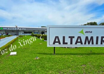 Mutirão de cirurgias de catarata em Altamira beneficia mais de 60 pacientes.