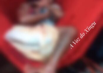 Mulher é esfaqueada por encapuzados enquanto amamentava bebê em Altamira, no Pará