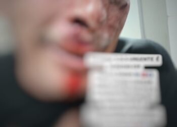 Vereador é agredido em bar durante a madrugada em Medicilândia (PA)