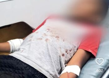 Empresário é acusado de atirar contra criança autista em Altamira; caso gera protesto por justiça