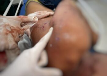 Motorista escolar é vítima de tentativa de homicídio em Senador José Porfírio (PA)