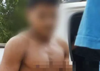 A imagem em destaque mostra a vítima com o arpão cravado no peito. (Foto: Reprodução | Notícia Marajó)