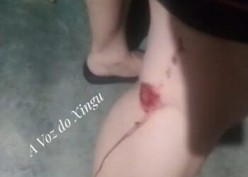 Ataque com explosivos em residência deixa feridos e assusta família em Vitória do Xingu