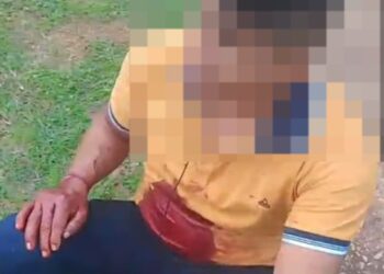 Dois indígenas parakanã são baleados em atentado próximo à Terra Indígena Apyterewa, no Pará. — Foto: Reprodução