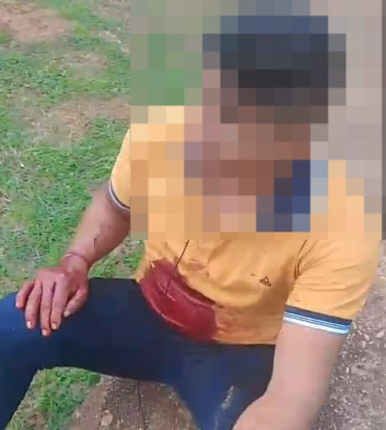 Dois indígenas parakanã são baleados em atentado próximo à Terra Indígena Apyterewa, no Pará. — Foto: Reprodução