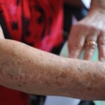 Novos casos de câncer devem quase dobrar até 2050, alerta OMS