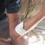 Homem fica ferido após ser atingido com garrafa durante confusão em bar de Vitória do Xingu