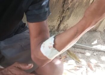 Homem fica ferido após ser atingido com garrafa durante confusão em bar de Vitória do Xingu